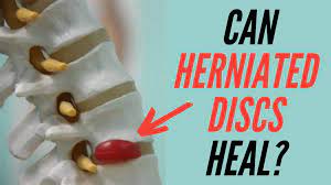 can a herniated disc heal itself