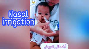 nasal irrigation with normal saline for