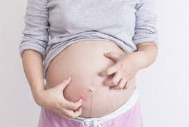 itchy belly during pregnancy home