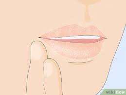 dry or ed lips wikihow