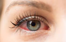 6 signs you need emergency eye care