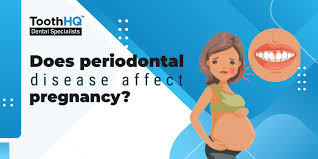 periodontal disease affect pregnancy