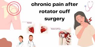 chronic pain after rotator cuff surgery