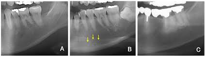 dental cone beam computed tomography