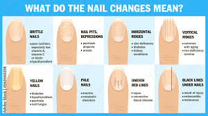 what do the nail changes mean the