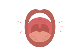 swollen mouth 7 reasons for mouth
