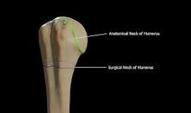 Image result for icd 10 code for left humeral surgical neck fracture