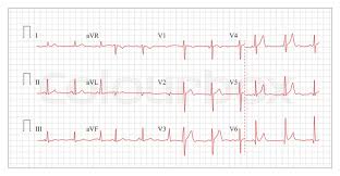 Heart Cardiogram Chart Vector Set Stock Vector