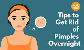 pimples and its treatment