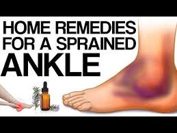 home remes for sprained ankle you