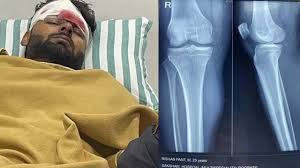 Rishabh Pant Health महत्वाची अपडेट, डॉक्टरांनी ऋषभला अजून हॉस्पिटलमध्ये का  ठेवलय? - rishabh pant health big update likely to be discharged in two weeks  form mumbai hospital reports | TV9 Marathi