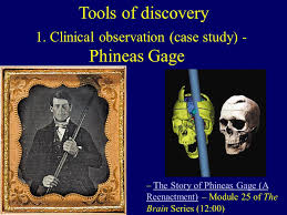Brain case study  Phineas Gage   Big Picture SlideShare