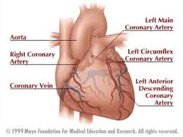 Damage to these arteries pos. Statistic Facts