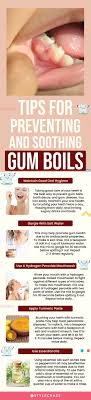 gum boil symptoms natural remes