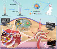 Low‐Intensity Focused Ultrasound‐Responsive Ferrite‐Encapsulated  Nanoparticles for Atherosclerotic Plaque Neovascularization Theranostics -  Yao - 2021 - Advanced Science - Wiley Online Library