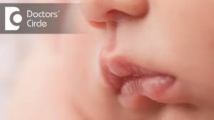 lip colour changes in infants