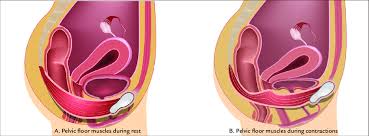 ilration of pelvic floor muscles at