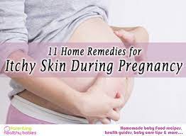 remes for itchy skin during pregnancy