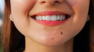 meaning of moles on diffe parts of