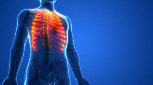 May 13, 2021 · the lungs sit inside your rib cage. Workers Compensation Benefits For A Broken Rib