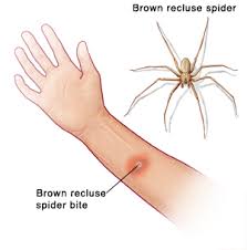 Image result for Brown recluse spider