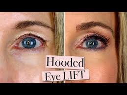 how i fixed my droopy hooded eyelids