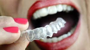 After about a year of wearing them at night, i let people know that now it's your turn to be an orthodontist. Orthodontists Aren T Smiling About Teeth Straightening Start Ups Los Angeles Times