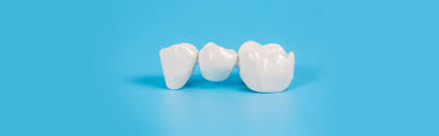 dental bridge to stop hurting