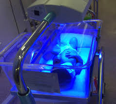 Just2me How Newborn With Jaundice Is Treated In Singapore
