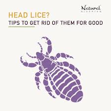 head lice tips to get rid of them for