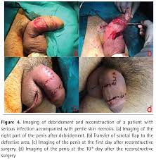 Journal of Urological Surgery