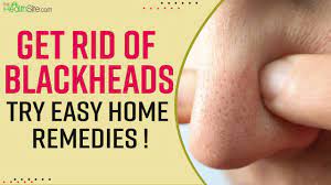 how to remove blackheads at home try
