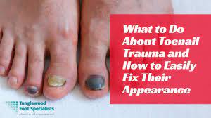 what to do about toenail trauma and how