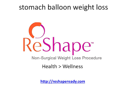 stomach balloon powerpoint ppt presentation