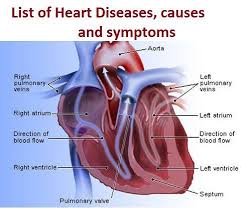 It is possible that hole in the heart shows no physical symptoms and still is present in a patient. Various Types Of Heart Diseases Causes And Symptoms