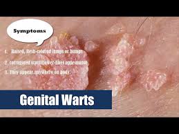 warts hpv human papilloma virus