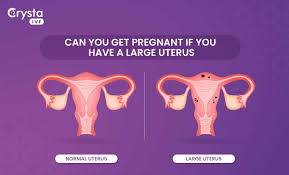 get pregnant with enlarged uterus