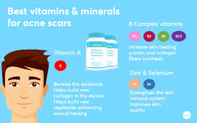According to the national institutes of health (nih) office of dietary supplements, the recommended amount of vitamin d for most adults in a day is 600 international. Best Vitamin Supplements For Acne Scars Mdacne