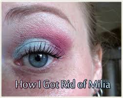 how i got rid of milia makeup your mind