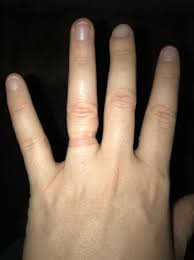 swelling in hands 7 weeks pregnant