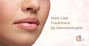 dark lips treatment by dermatologist
