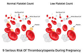 Thrombocytopenia Low Platelets In Pregnancy Causes Risks