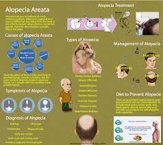Hair loss (alopecia) can affect just your scalp or your entire body, and it can be temporary or permanent. What Is Alopecia Areata Causes Types Treatment Of Alopecia
