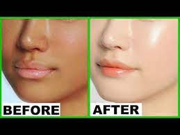 skin whitening home remes