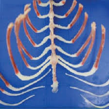 Structure of a typical rib: Posterior View Of The Rabbit Rib Cage Those Attached To The Sternum Download Scientific Diagram