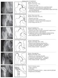 fem varus derotational osteotomy