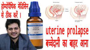uterine prolapse how to cure uterine