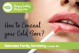 stop a cold sore fast tips from