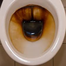 brown stains in my toilet bowl