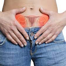 endometriosis and ovulation pelvic